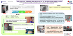 Thumbnail for PICC difficult removal: an experience of an Intravenous Therapy Team