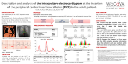 Thumbnail for Description and analysis of the intracavitary electrocardiogram at the insertion of the peripheral central insertion catheter (PICC) in the adult patient