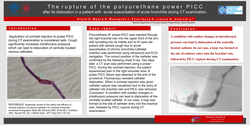 Thumbnail for The fracture of the polyuretane power PICC after dislocation in a patient with acute exacerbation of acute brochitis