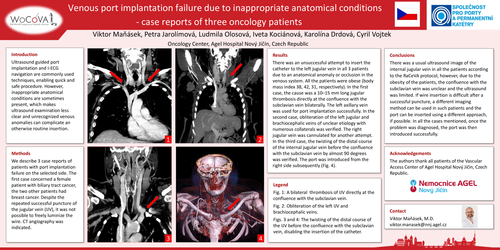 Preview of Venous port implantation failure due to inappropriate anatomical conditions - case reports of three oncology patients