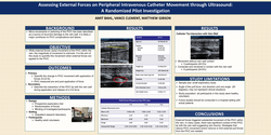 Thumbnail for Assessing External Forces on Peripheral Intravenous Catheter Movement through Ultrasound: A Randomized Pilot Investigation
