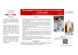 Thumbnail for The challenge of a PICC in a burn patient