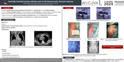 Thumbnail for Centrally inserted central catheter port in the femoral vein: the last resource