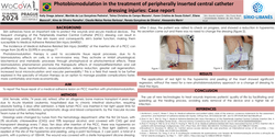 Thumbnail for Photobiomodulation and Peripherally Inserted Central Catheter Dressing Injury: Case Report